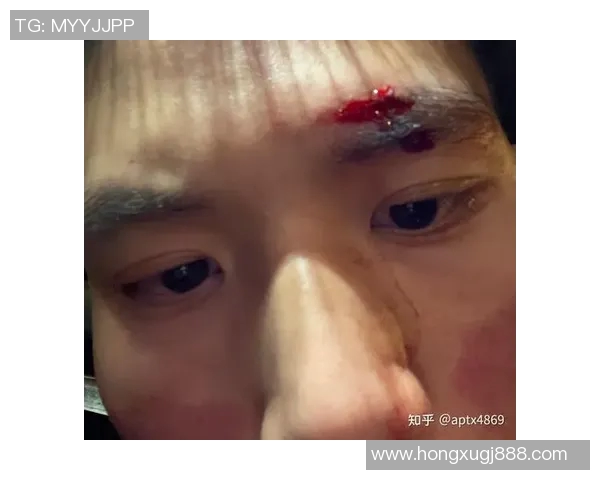 足球明星眉骨受伤紧急缝针现场直击引发球迷热议与关注